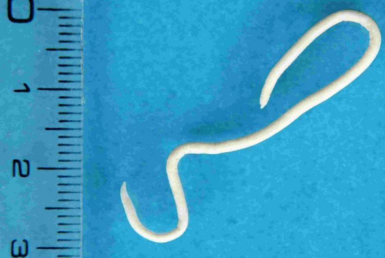 Description des parasites humains
