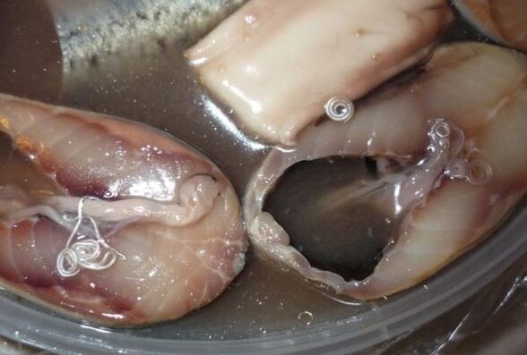 voies d'infection humaine par des parasites