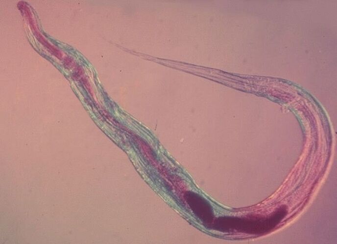 L'oxyure au microscope